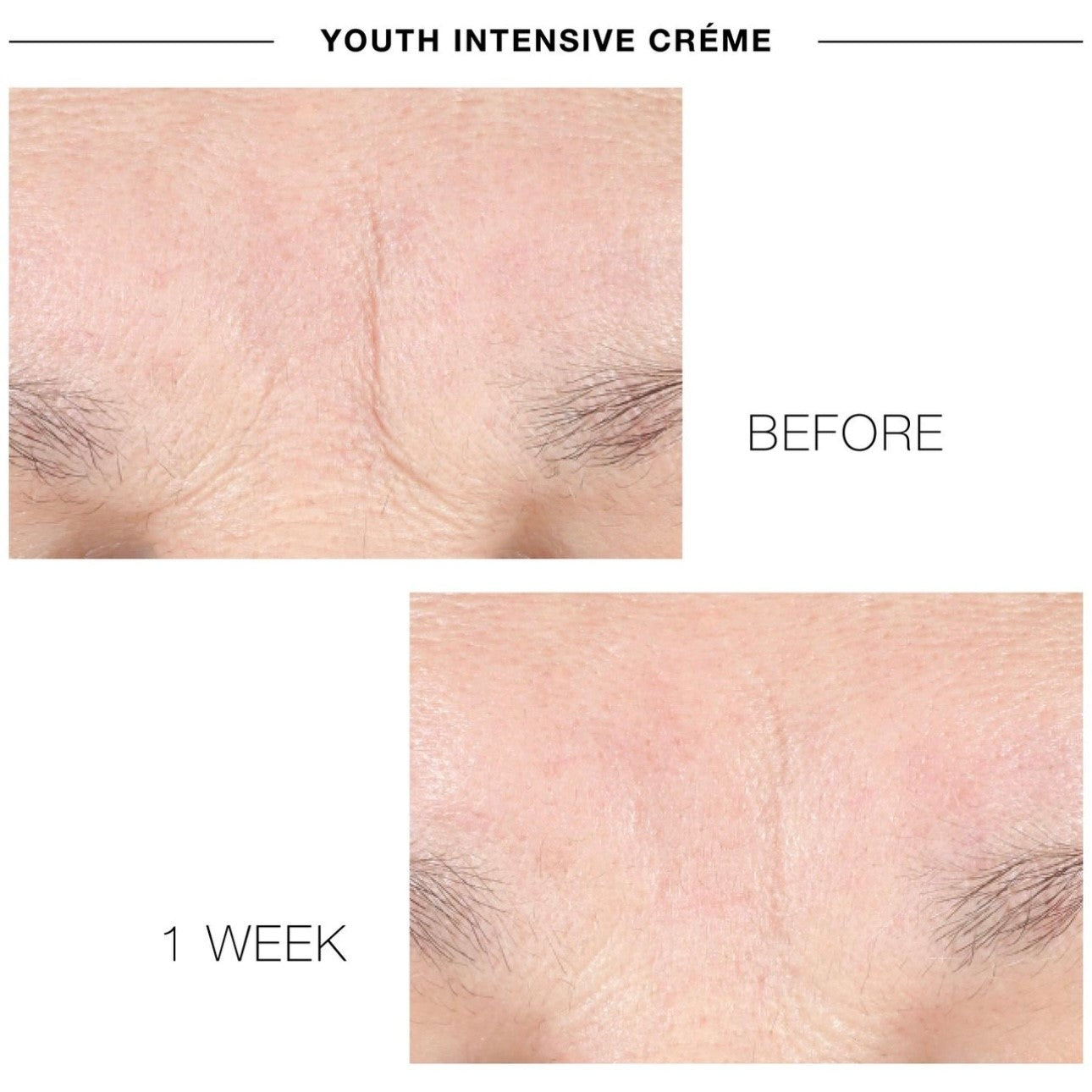 YOUTH INTENSIVE CREME