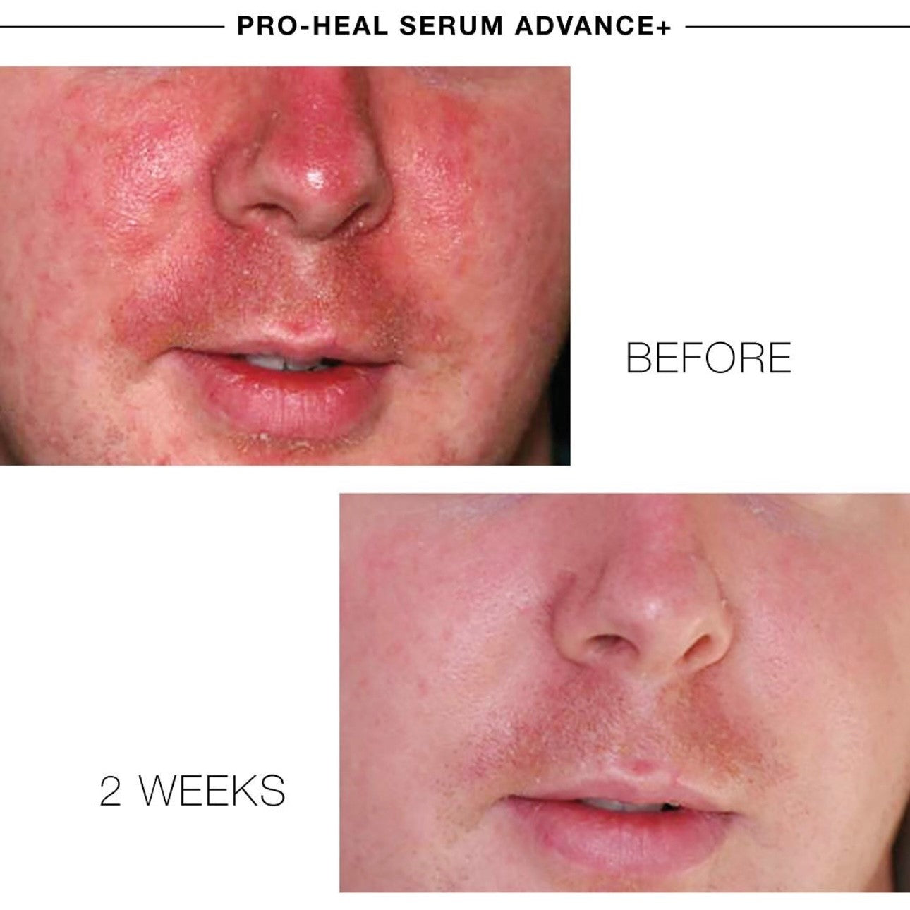 PRO-HEALTH SERUM ADVANCE+