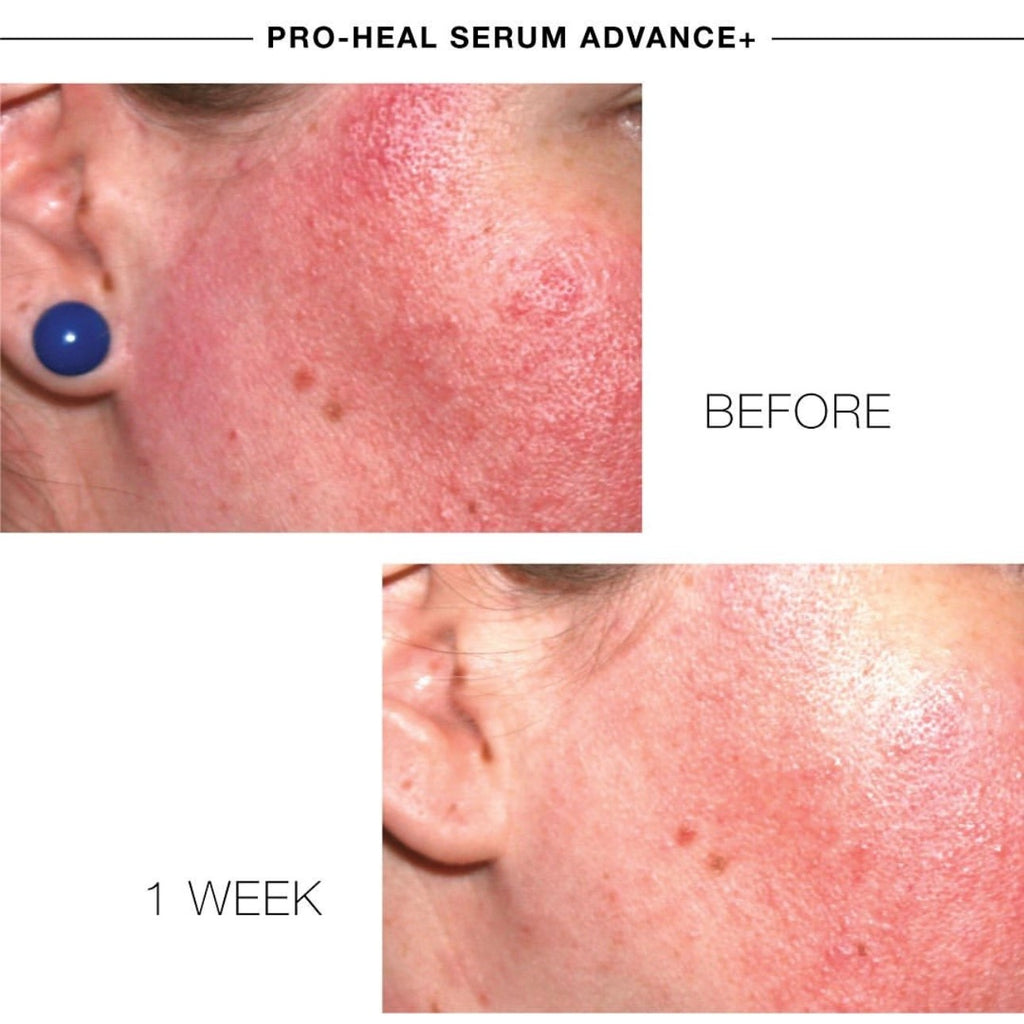 PRO-HEALTH SERUM ADVANCE+