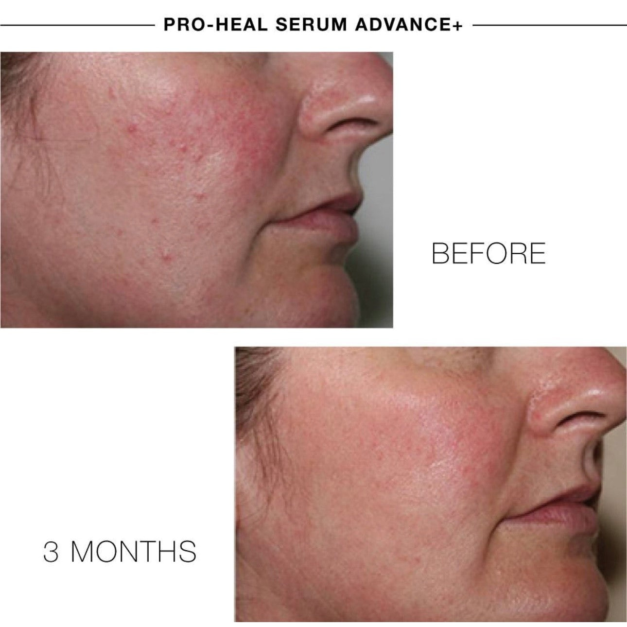 PRO-HEALTH SERUM ADVANCE+