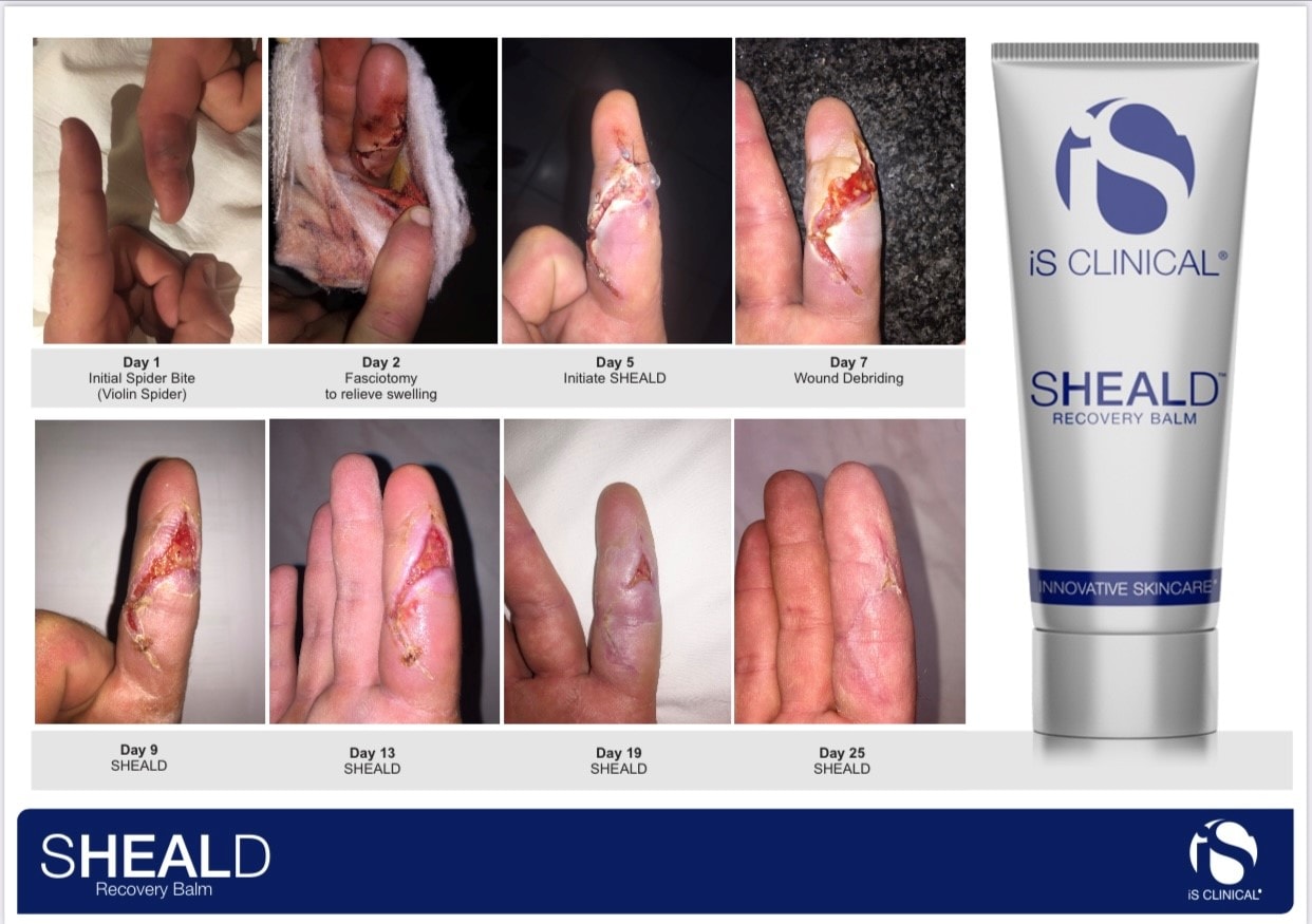 SHEALD RECOVERY BALM